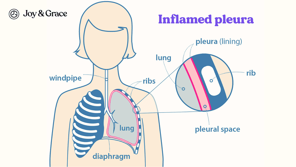 Inflamed pleura