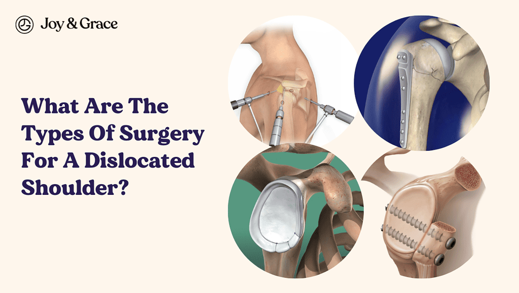 illustration of four types of surgery for a dislocated shoulder