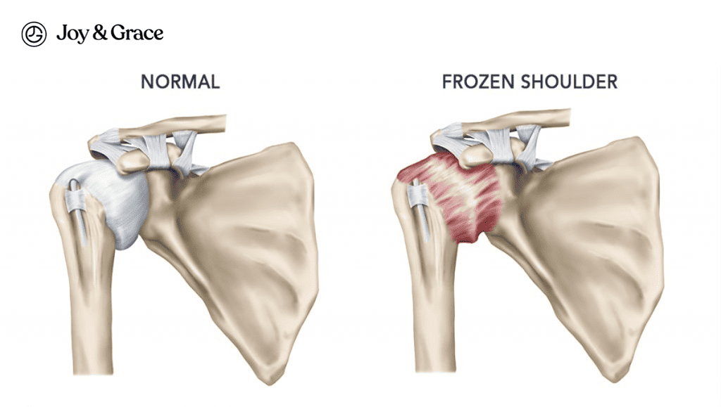 the anatomy of the shoulder joint is highlighted