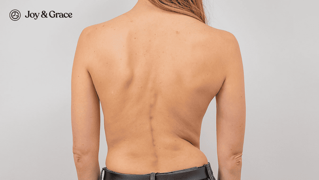 a woman is showing off her back bad posture