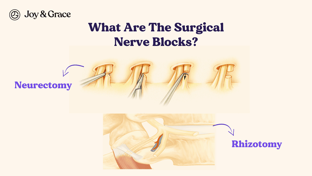 a diagram showing what the surgical nerve blocks