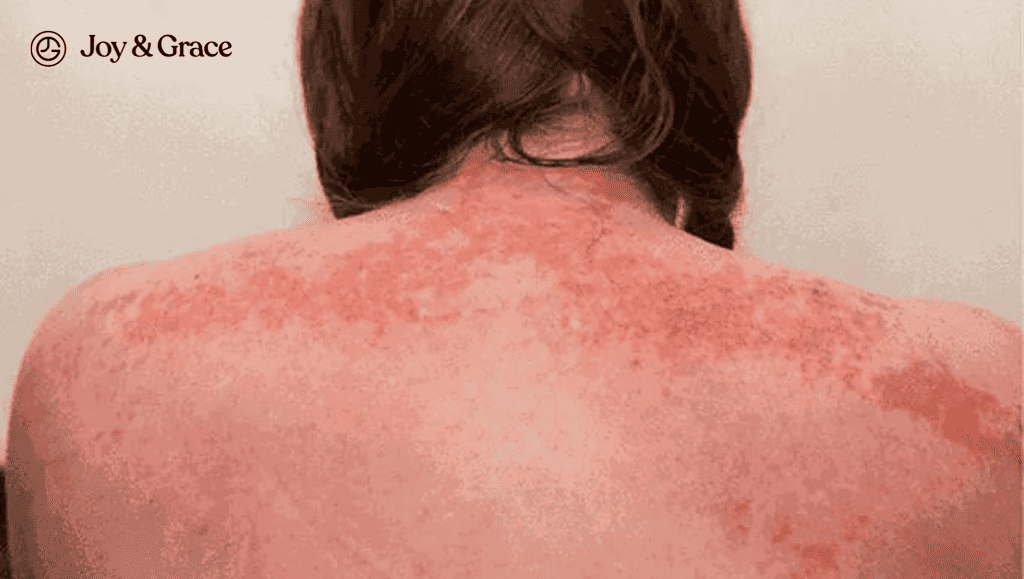 the back of a man with red skin