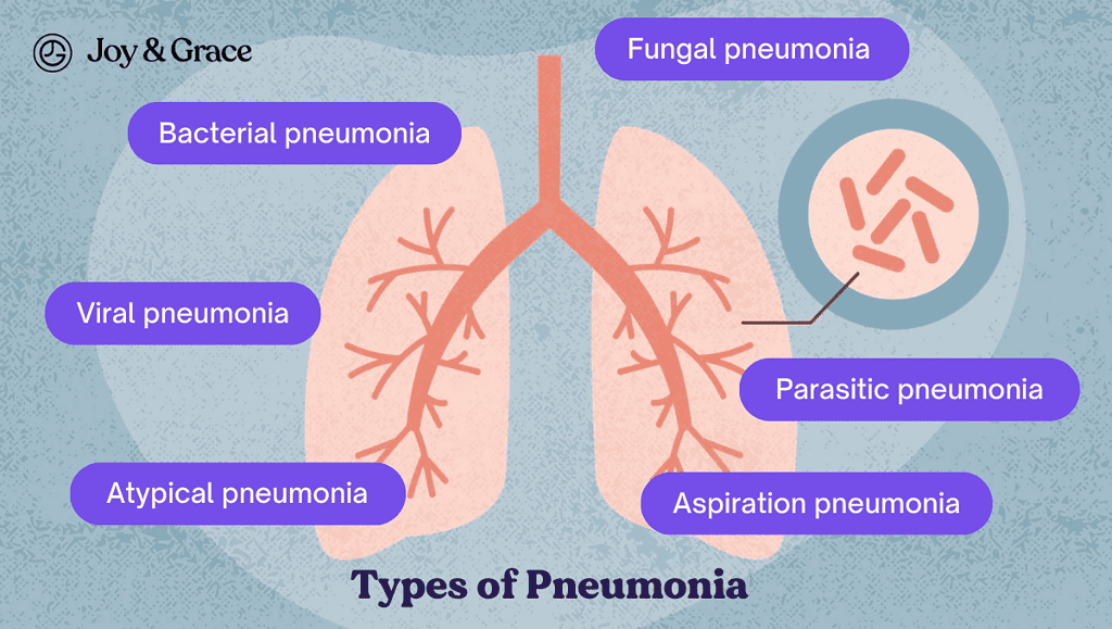 Types of Pneumonia