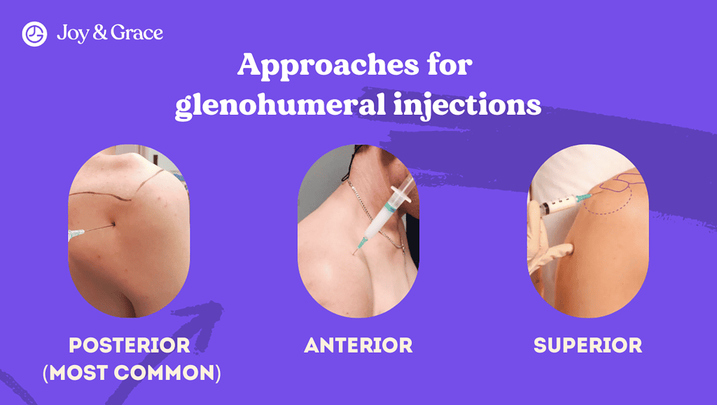 approaches for glenohumeral injections