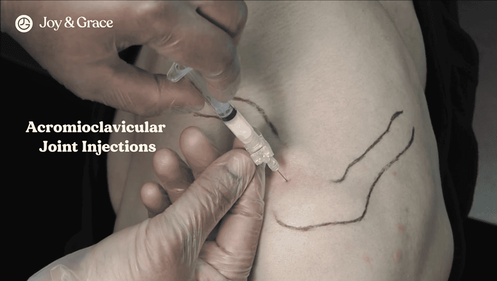 acromioclavicular joint injections