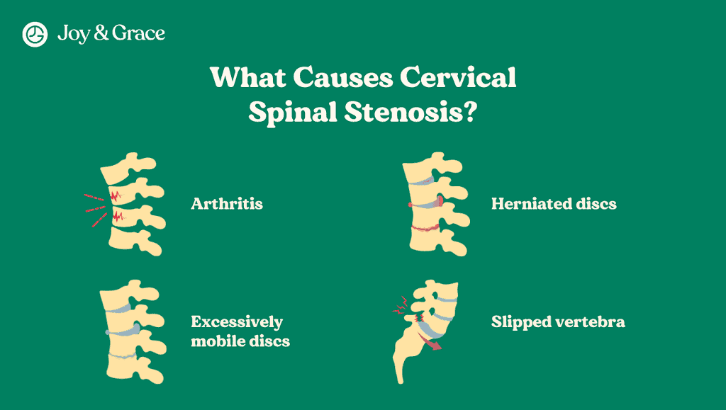 illustration of different causes of cervical spinal stenosis