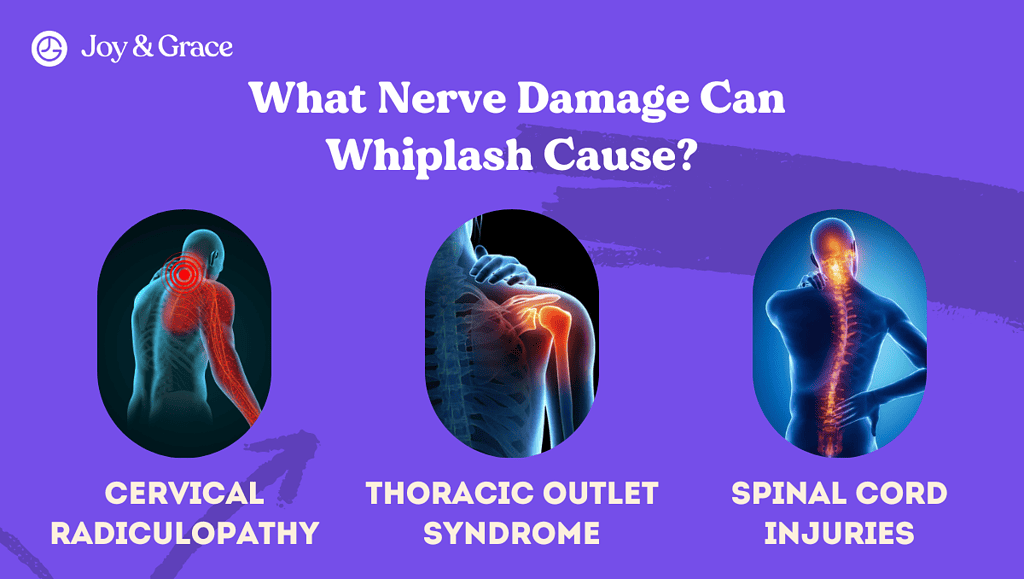 What Nerve Damage Can Whiplash Cause