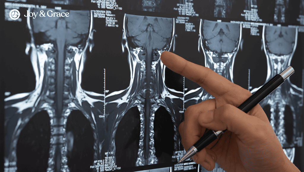 x-ray of a whiplash