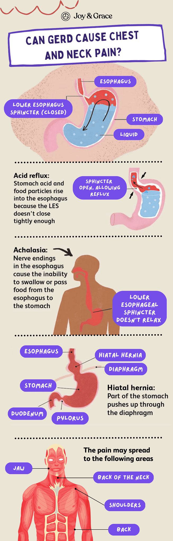 Acid Reflux And Neck Pain: What You Should Know