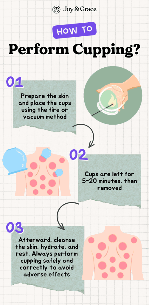 How to perform cupping