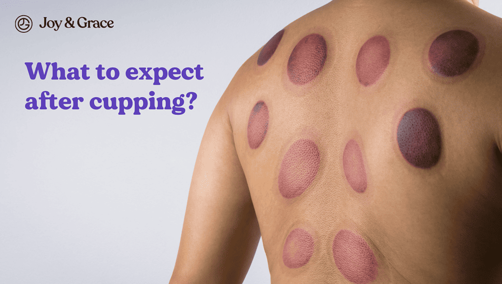 What to expect after cupping