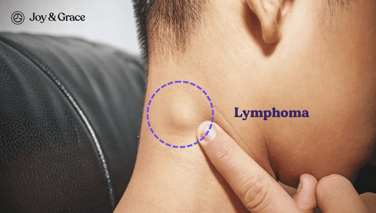 lymphoma behind ear