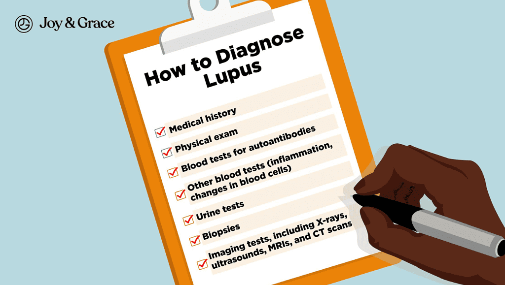 Diagnostic process for lupus