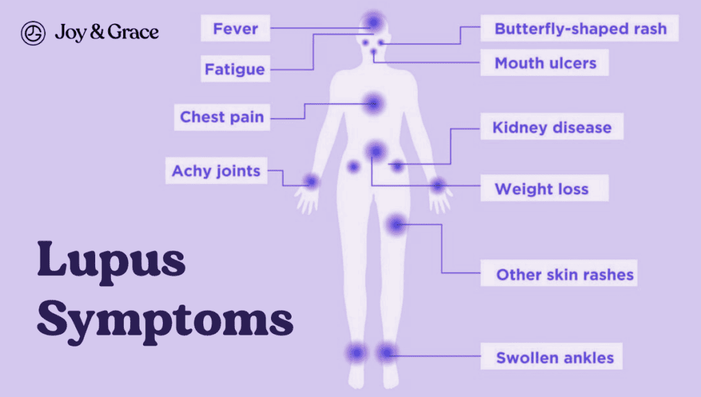 Shoulder and hip pain are common symptoms of lupus, a chronic autoimmune disease. Understanding lupus symptoms is crucial for accurate diagnosis and appropriate treatment. Explore effective options for managing lupus symptoms and