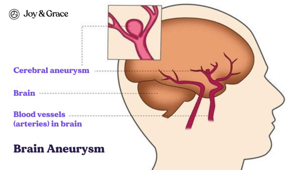 A diagram of the brain highlighting the Left Side and its connection to Pain in the Neck.