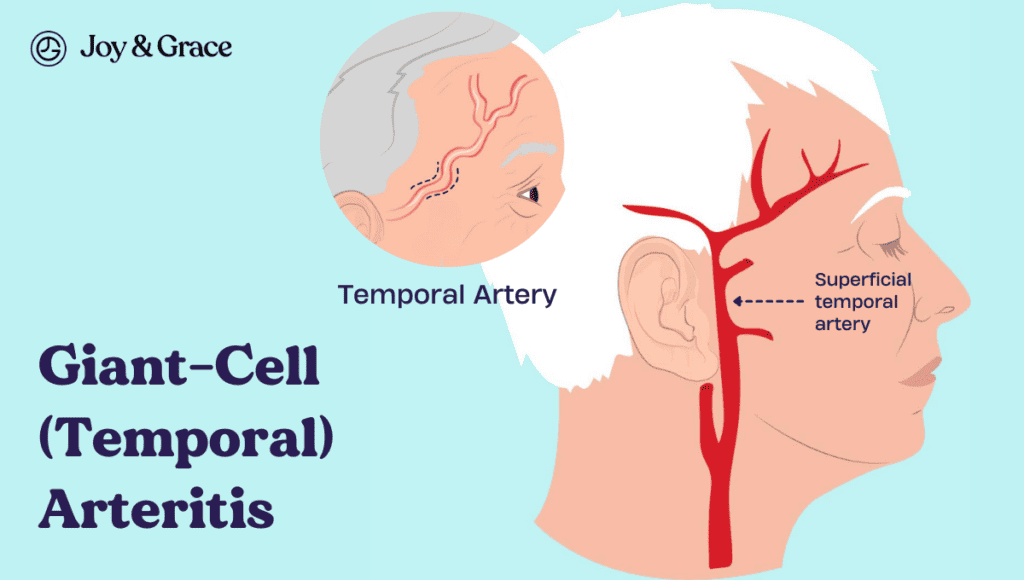 A diagram showcasing the left side of a person's head and indicating potential neck pain.