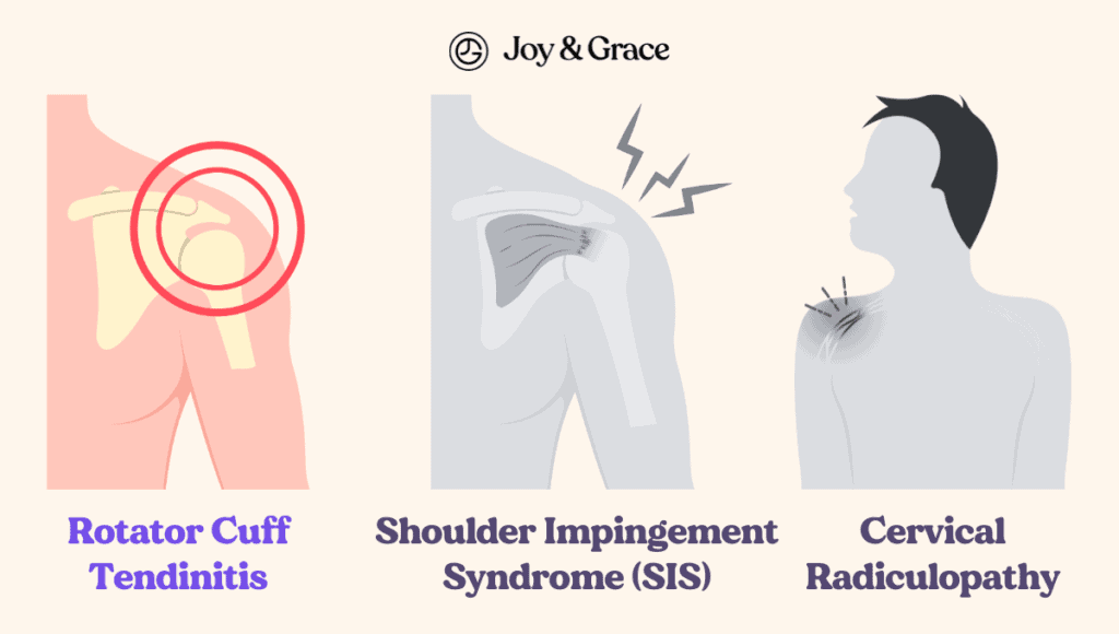 The Rotator Cuff Impingement Syndrome can cause severe shoulder pain and discomfort, often leading to cervical tetanus. This condition can be debilitating and require immediate relief measures.