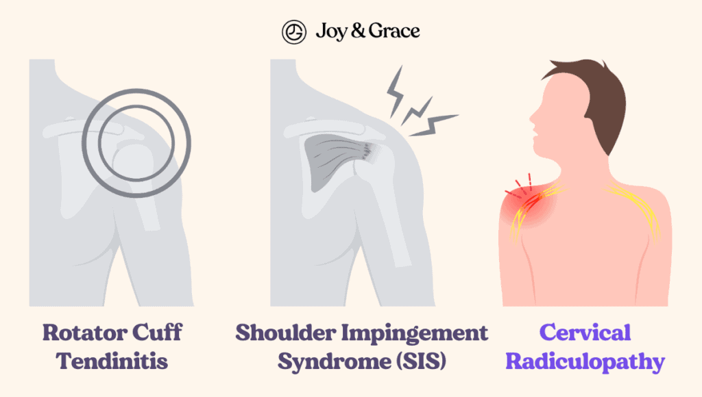 This description focuses on a condition related to pain in the shoulder and tricep muscles, specifically related to rotator cuff impingement.