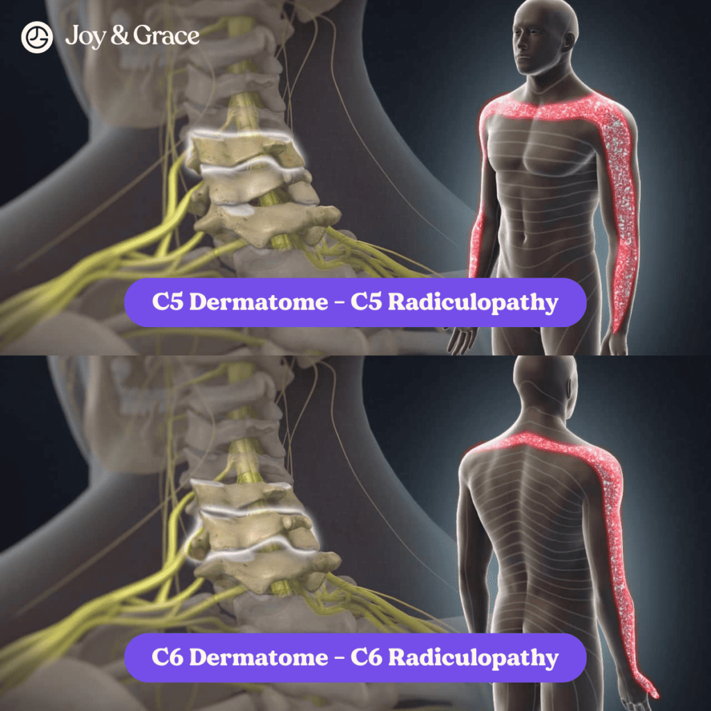 Ccd dermatosis causing shoulder pain.