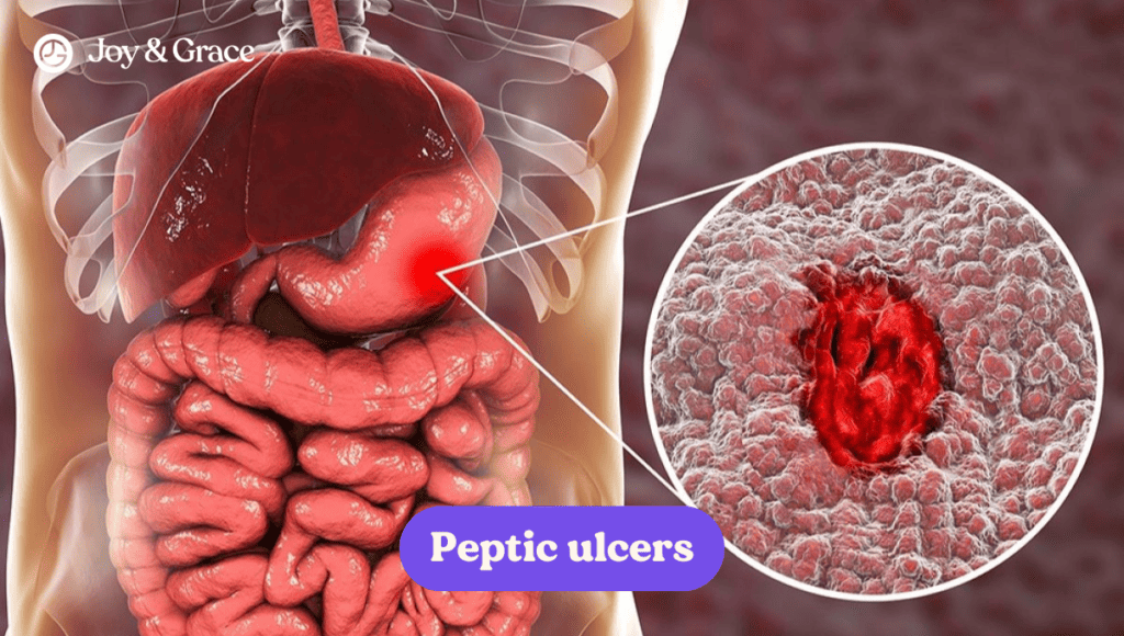 Back pain in the left shoulder blade caused by peripheral vesicles.