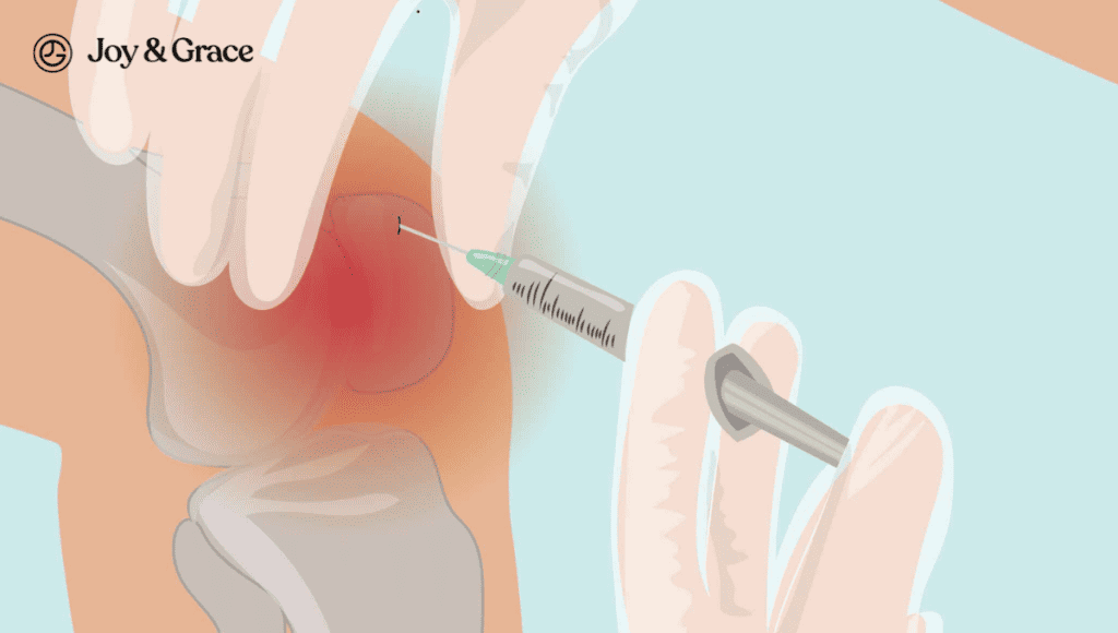 An illustration of a person receiving a knee injection, specifically a cortisone shot.