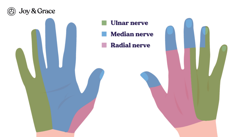 A diagram of the hand showing the different types of nerves, specifically focusing on Carpal Tunnel Syndrome.